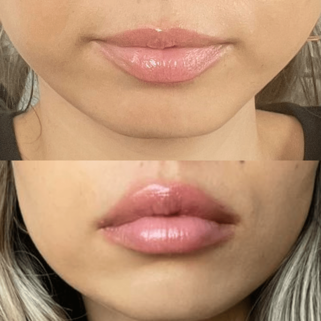 Lips Plumper Gloss